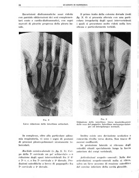 Quaderni di radiologia rivista di collaborazione clinico-radiologica fondata da M. Lapenna