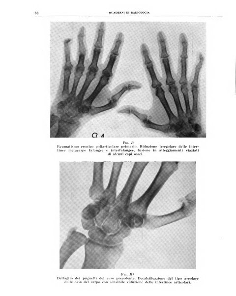 Quaderni di radiologia rivista di collaborazione clinico-radiologica fondata da M. Lapenna