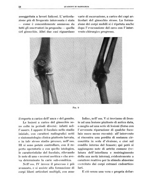 Quaderni di radiologia rivista di collaborazione clinico-radiologica fondata da M. Lapenna