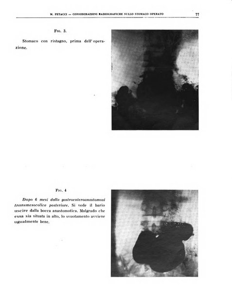 Quaderni di radiologia rivista di collaborazione clinico-radiologica fondata da M. Lapenna