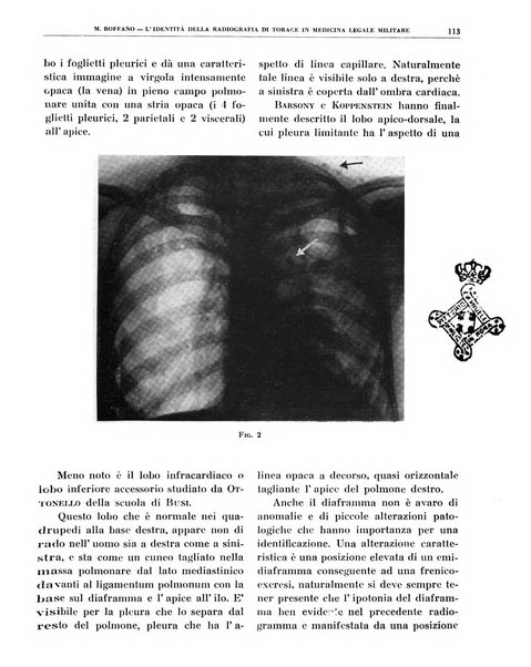 Quaderni di radiologia rivista di collaborazione clinico-radiologica fondata da M. Lapenna