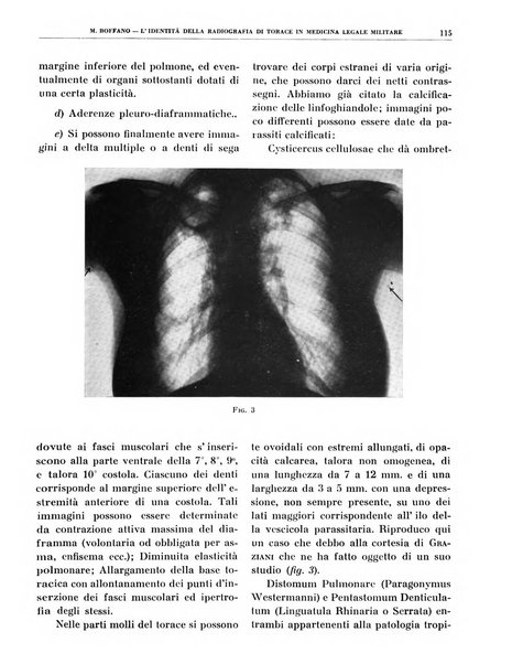 Quaderni di radiologia rivista di collaborazione clinico-radiologica fondata da M. Lapenna