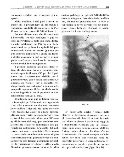 Quaderni di radiologia rivista di collaborazione clinico-radiologica fondata da M. Lapenna