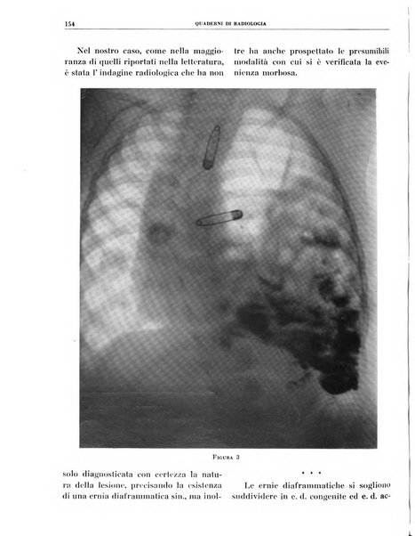 Quaderni di radiologia rivista di collaborazione clinico-radiologica fondata da M. Lapenna