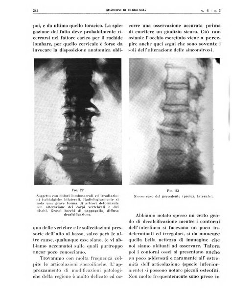 Quaderni di radiologia rivista di collaborazione clinico-radiologica fondata da M. Lapenna