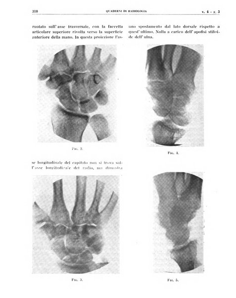 Quaderni di radiologia rivista di collaborazione clinico-radiologica fondata da M. Lapenna