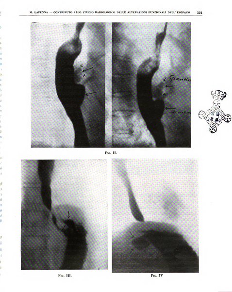 Quaderni di radiologia rivista di collaborazione clinico-radiologica fondata da M. Lapenna