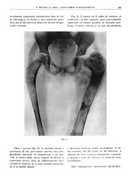 Quaderni di radiologia rivista di collaborazione clinico-radiologica fondata da M. Lapenna