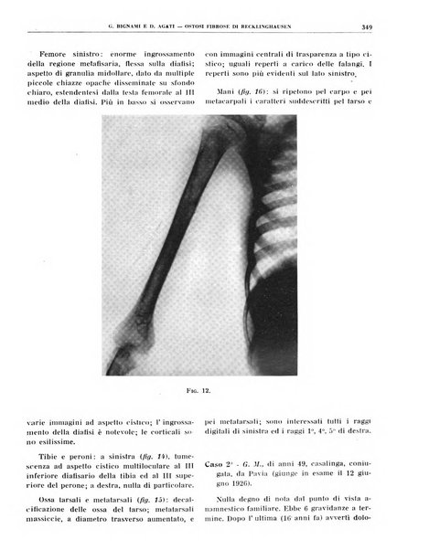 Quaderni di radiologia rivista di collaborazione clinico-radiologica fondata da M. Lapenna