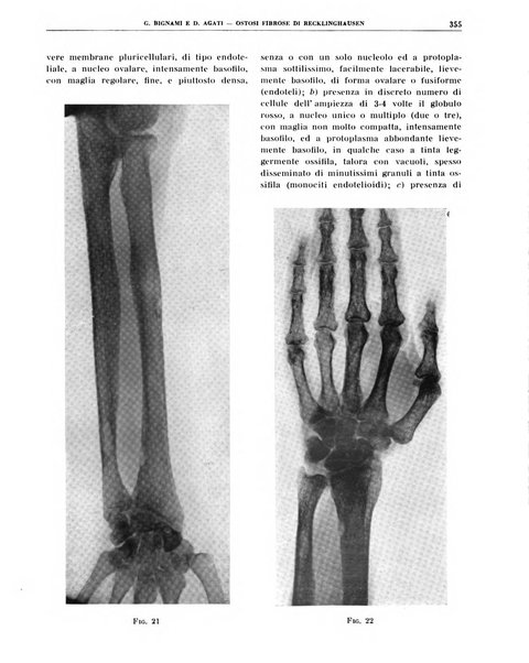 Quaderni di radiologia rivista di collaborazione clinico-radiologica fondata da M. Lapenna