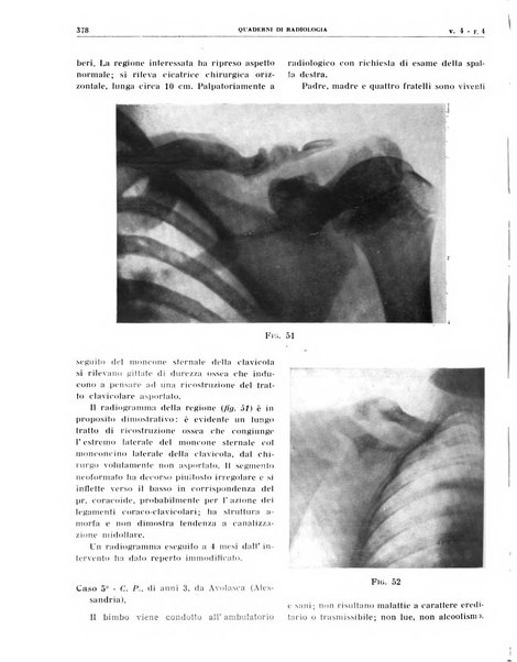 Quaderni di radiologia rivista di collaborazione clinico-radiologica fondata da M. Lapenna