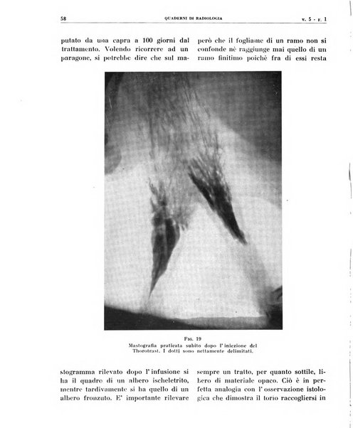 Quaderni di radiologia rivista di collaborazione clinico-radiologica fondata da M. Lapenna