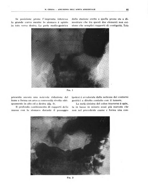 Quaderni di radiologia rivista di collaborazione clinico-radiologica fondata da M. Lapenna