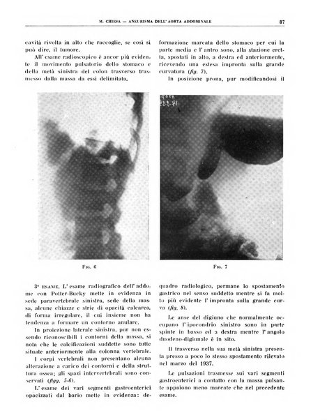 Quaderni di radiologia rivista di collaborazione clinico-radiologica fondata da M. Lapenna