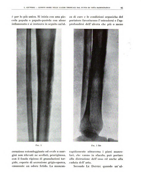 Quaderni di radiologia rivista di collaborazione clinico-radiologica fondata da M. Lapenna