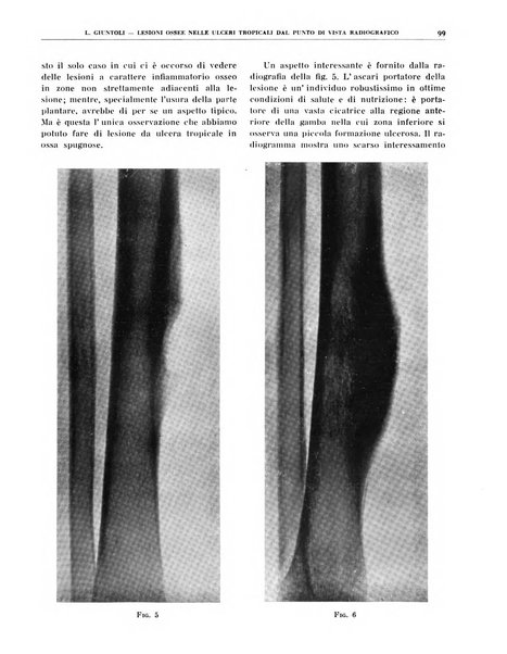 Quaderni di radiologia rivista di collaborazione clinico-radiologica fondata da M. Lapenna