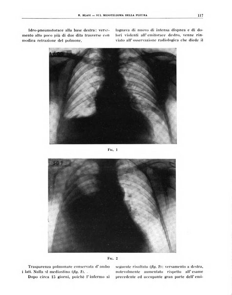 Quaderni di radiologia rivista di collaborazione clinico-radiologica fondata da M. Lapenna