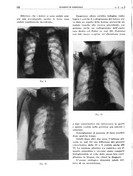 Quaderni di radiologia rivista di collaborazione clinico-radiologica fondata da M. Lapenna