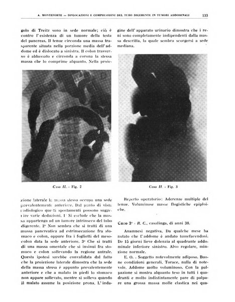 Quaderni di radiologia rivista di collaborazione clinico-radiologica fondata da M. Lapenna