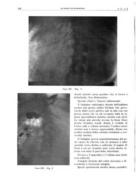 Quaderni di radiologia rivista di collaborazione clinico-radiologica fondata da M. Lapenna