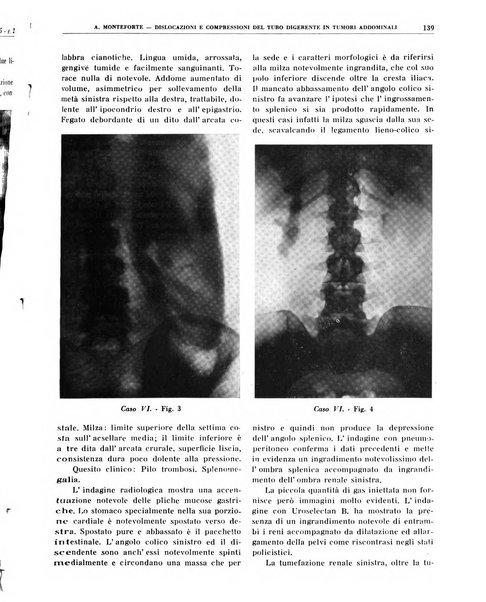 Quaderni di radiologia rivista di collaborazione clinico-radiologica fondata da M. Lapenna