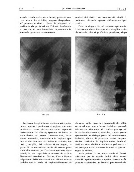 Quaderni di radiologia rivista di collaborazione clinico-radiologica fondata da M. Lapenna