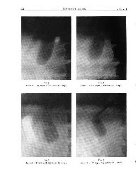 Quaderni di radiologia rivista di collaborazione clinico-radiologica fondata da M. Lapenna