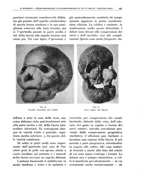 Quaderni di radiologia rivista di collaborazione clinico-radiologica fondata da M. Lapenna