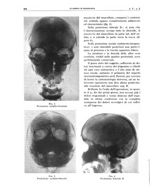 Quaderni di radiologia rivista di collaborazione clinico-radiologica fondata da M. Lapenna