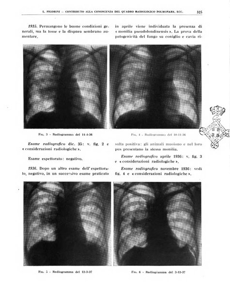 Quaderni di radiologia rivista di collaborazione clinico-radiologica fondata da M. Lapenna