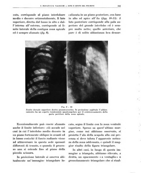 Quaderni di radiologia rivista di collaborazione clinico-radiologica fondata da M. Lapenna