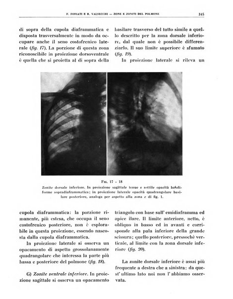 Quaderni di radiologia rivista di collaborazione clinico-radiologica fondata da M. Lapenna