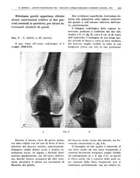 Quaderni di radiologia rivista di collaborazione clinico-radiologica fondata da M. Lapenna