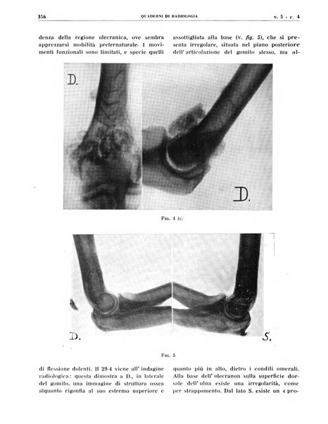 Quaderni di radiologia rivista di collaborazione clinico-radiologica fondata da M. Lapenna