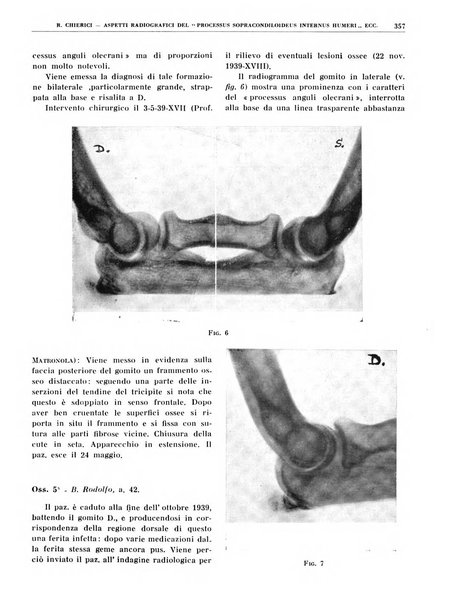 Quaderni di radiologia rivista di collaborazione clinico-radiologica fondata da M. Lapenna