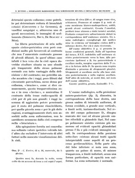 Quaderni di radiologia rivista di collaborazione clinico-radiologica fondata da M. Lapenna