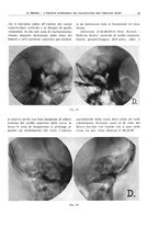 giornale/TO00191959/1941/unico/00000045