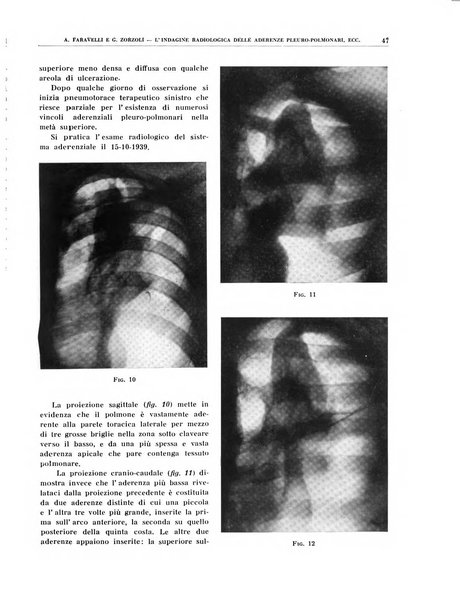 Quaderni di radiologia rivista di collaborazione clinico-radiologica fondata da M. Lapenna