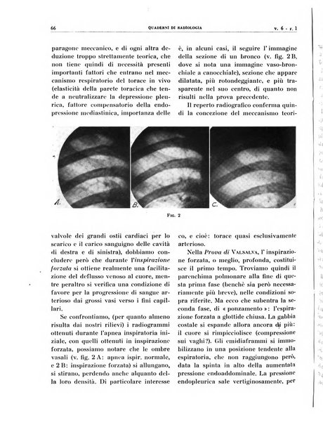 Quaderni di radiologia rivista di collaborazione clinico-radiologica fondata da M. Lapenna