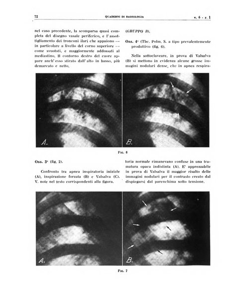 Quaderni di radiologia rivista di collaborazione clinico-radiologica fondata da M. Lapenna