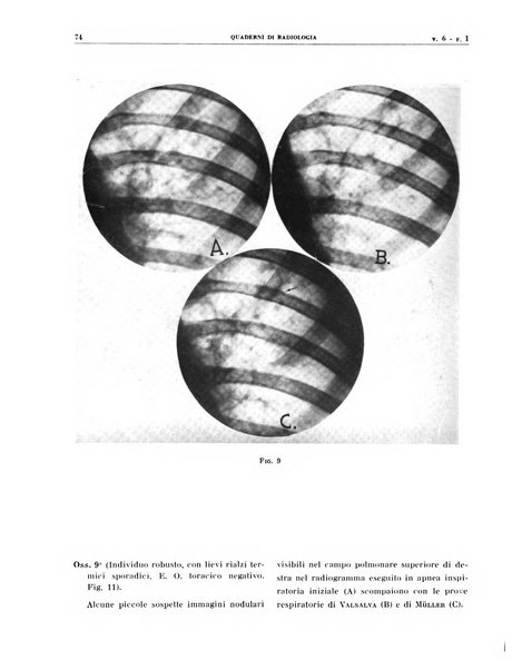 Quaderni di radiologia rivista di collaborazione clinico-radiologica fondata da M. Lapenna