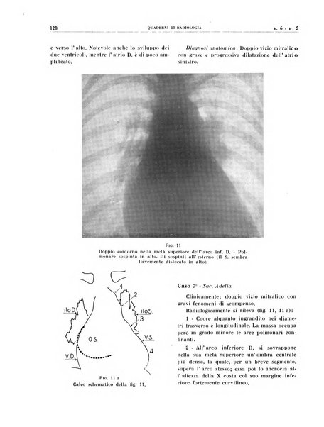 Quaderni di radiologia rivista di collaborazione clinico-radiologica fondata da M. Lapenna