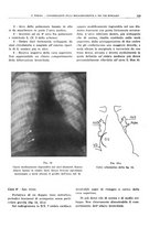 giornale/TO00191959/1941/unico/00000155