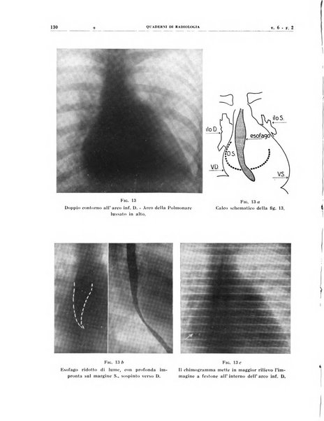 Quaderni di radiologia rivista di collaborazione clinico-radiologica fondata da M. Lapenna