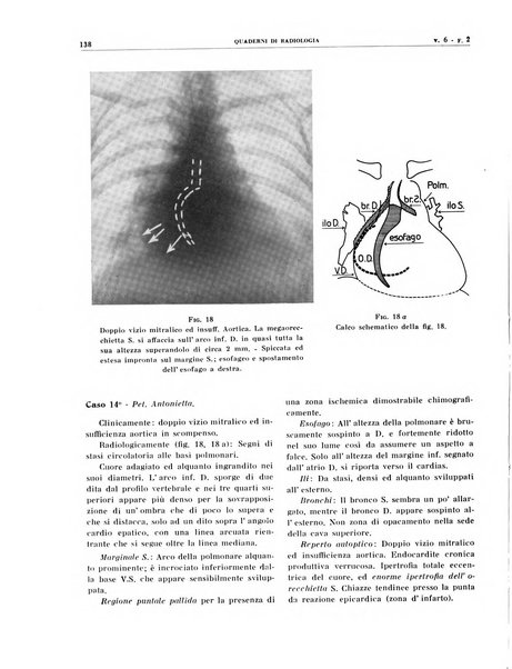 Quaderni di radiologia rivista di collaborazione clinico-radiologica fondata da M. Lapenna