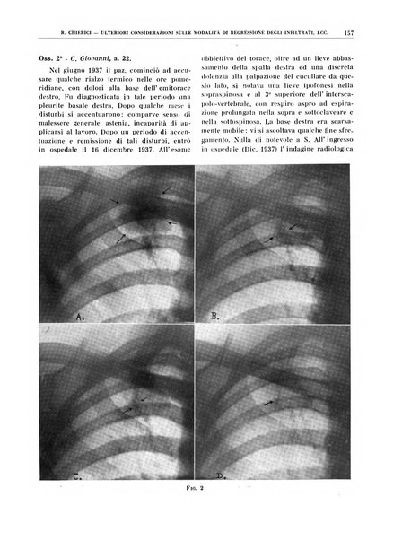 Quaderni di radiologia rivista di collaborazione clinico-radiologica fondata da M. Lapenna