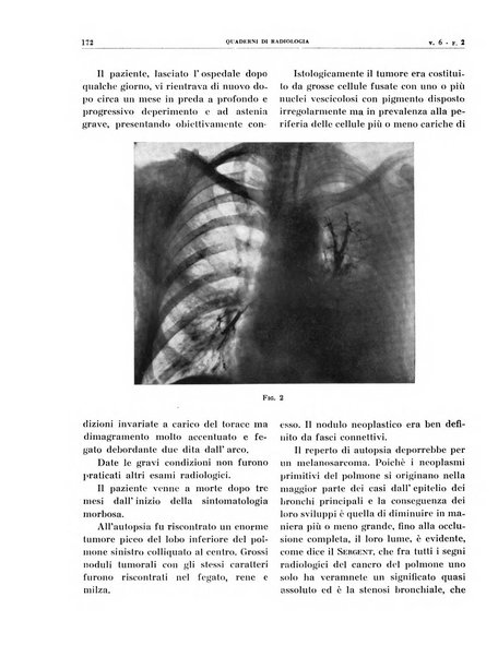 Quaderni di radiologia rivista di collaborazione clinico-radiologica fondata da M. Lapenna