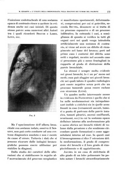 Quaderni di radiologia rivista di collaborazione clinico-radiologica fondata da M. Lapenna