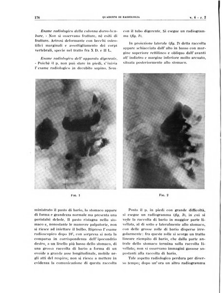 Quaderni di radiologia rivista di collaborazione clinico-radiologica fondata da M. Lapenna