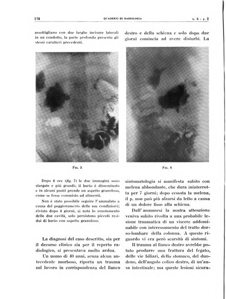 Quaderni di radiologia rivista di collaborazione clinico-radiologica fondata da M. Lapenna